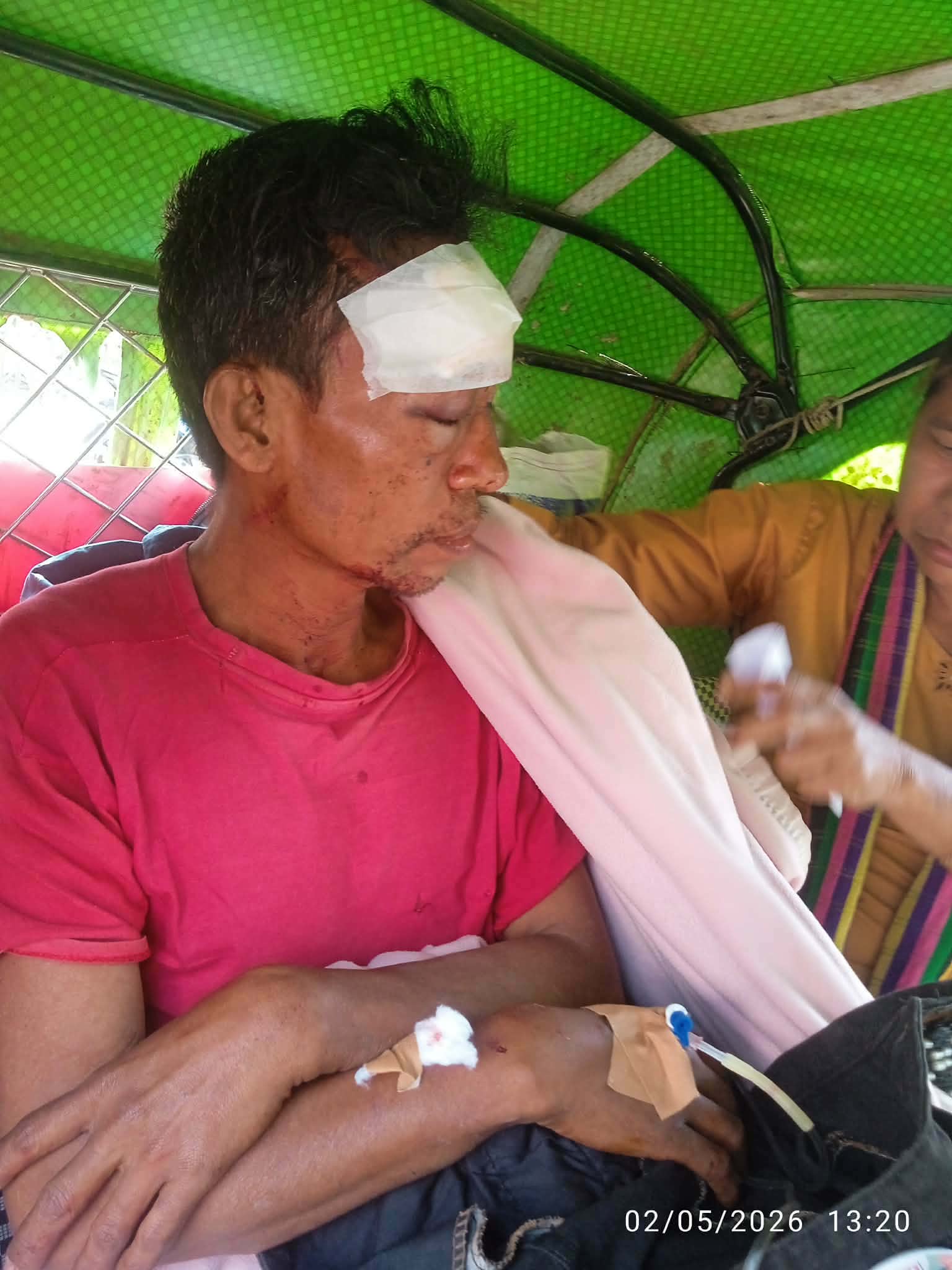 রাজস্থলীতে মুখোমূখি মোটরসাইকেল সংঘর্ষে ৩ জন গুরুতর আহত, একজনের অবস্থা আশংকাজনক